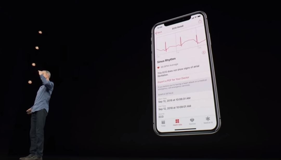 On obtient un tracé dans l'application Santé sur son smartphone. On peut l'envoyer ensuite sous forme de PDF à son médecin.