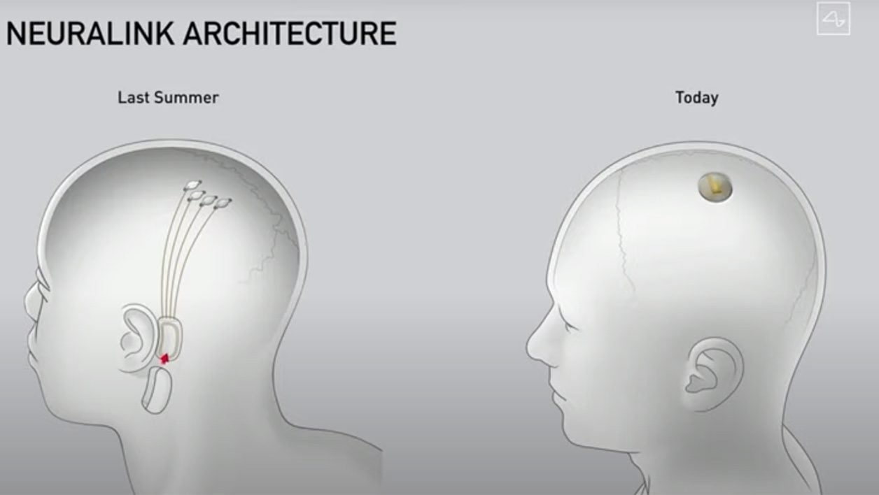 Comparaison entre le design de Neuralink de l'année dernière et le nouveau.