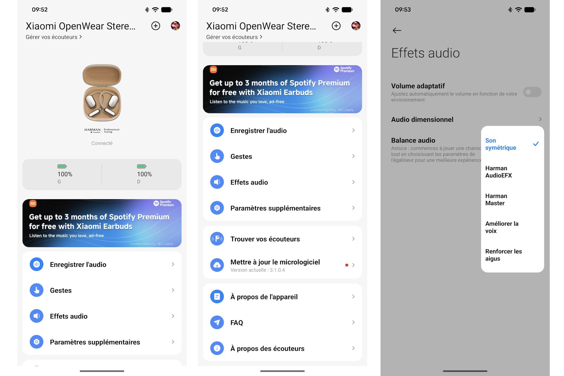 Xiaomi Openwear Stereo Pro 11
