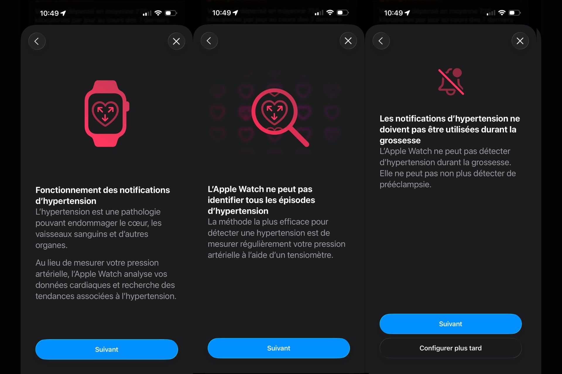 Apple Watch Tension Sanguine